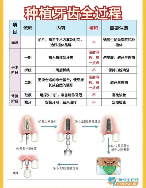 牙疼上火吃什么水果好治疗方法有哪些，口腔种植牙手术视频。 牙疼上火吃什么水果好治疗方法有哪些，口腔种植牙手术视频。 家禽养殖